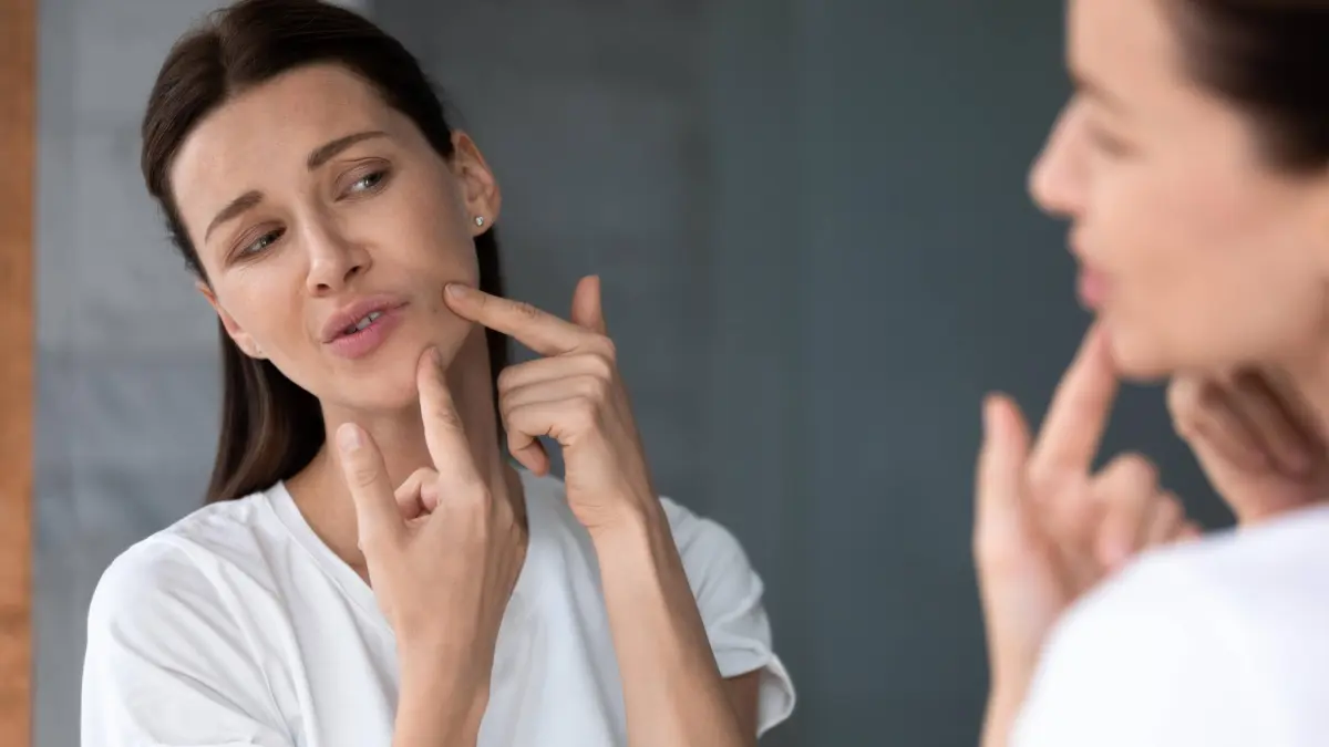 Verrugas: &iquest;por qu&eacute; salen, cu&aacute;l es su prevenci&oacute;n y tratamiento?